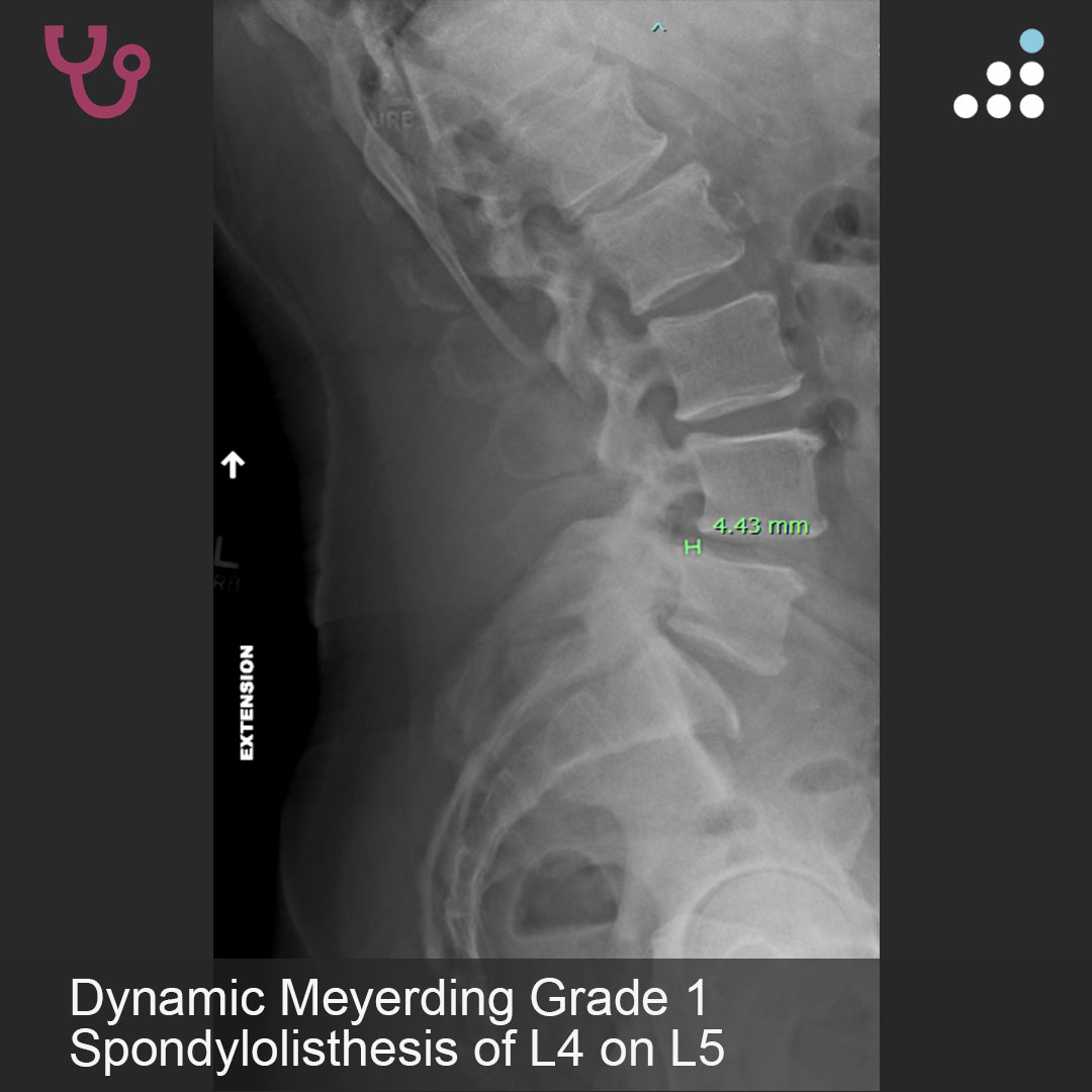 Orthobullets tweet media