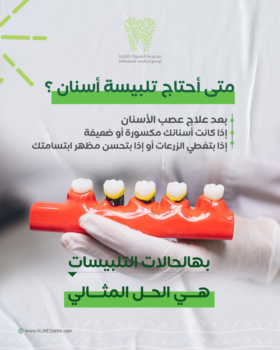 متى أحتاج تلبيسة أسنان؟ 🦷✨
•إذا كانت أسنانك مكسورة أو ضعيفة.
•بعد علاج عصب الأسنان.
•لتغطية الزرعات أو تحسين مظهر ابتسامتك.

بهالحالات، التلبيسات هي الحل المثالي! ✅

#تلبيسات_أسنان #ابتسامة_جميلة #علاج_أسنان #عناية_بالأسنان #صحة_الفم #ابتسامة_مشرقة
#تلبيسات_أسنان