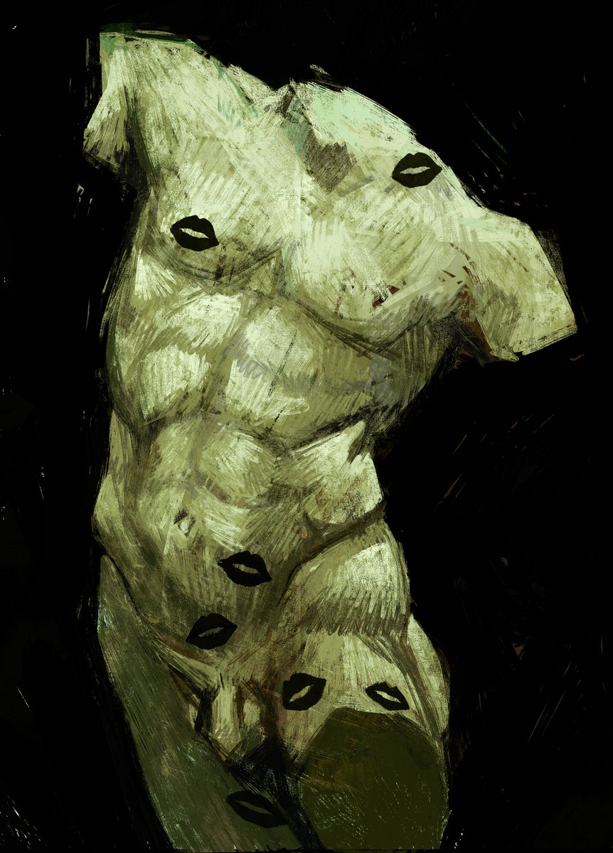 vertigo and vitiligo