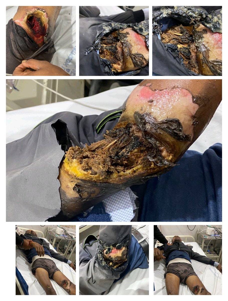 मध्यप्रदेश संविदा एवं ठेका श्रमिक कर्मचारी संघ tweet media