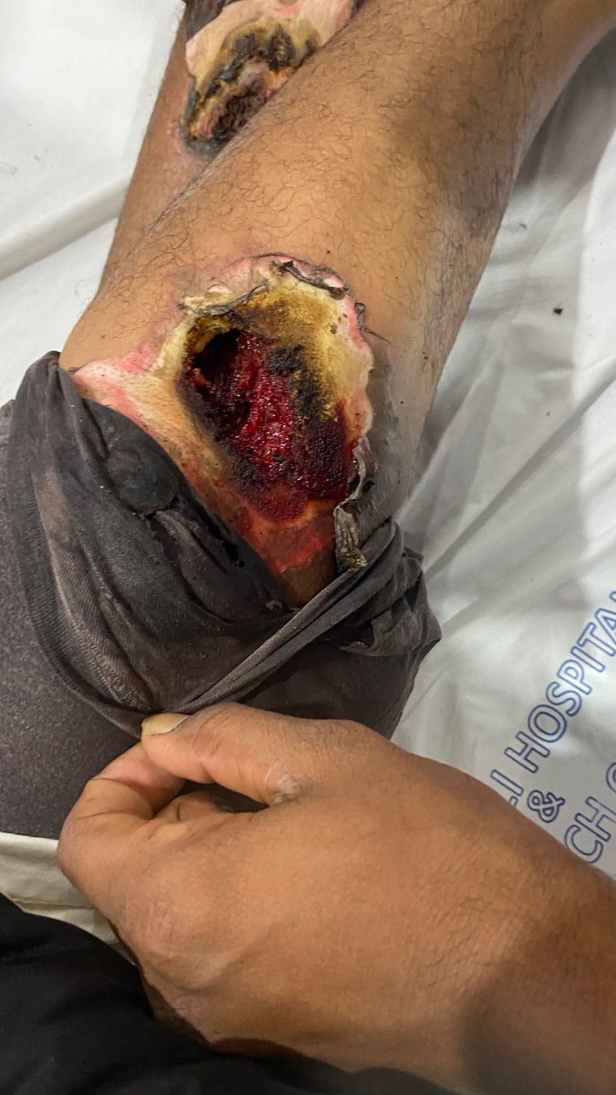 मध्यप्रदेश संविदा एवं ठेका श्रमिक कर्मचारी संघ tweet media