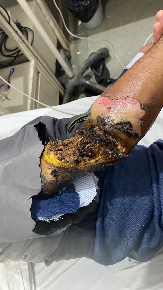 मध्यप्रदेश संविदा एवं ठेका श्रमिक कर्मचारी संघ tweet media