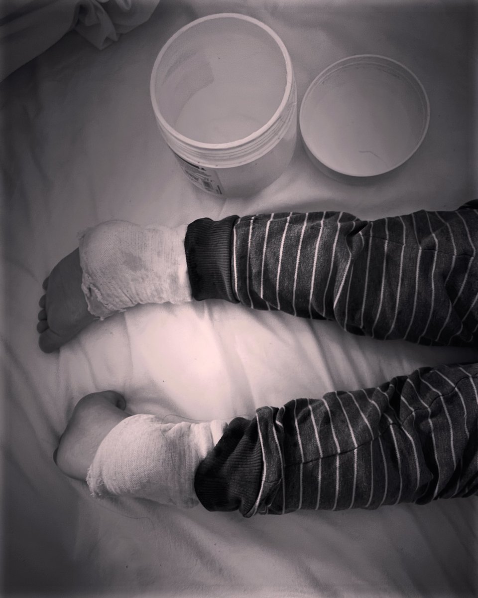 Jessicaacaa's tweet image. Food allergies are 💩 Please sign our petition for better labelling #allergies #foodallergies #potato #potatoallergy petitions.senedd.wales/petitions/2464…