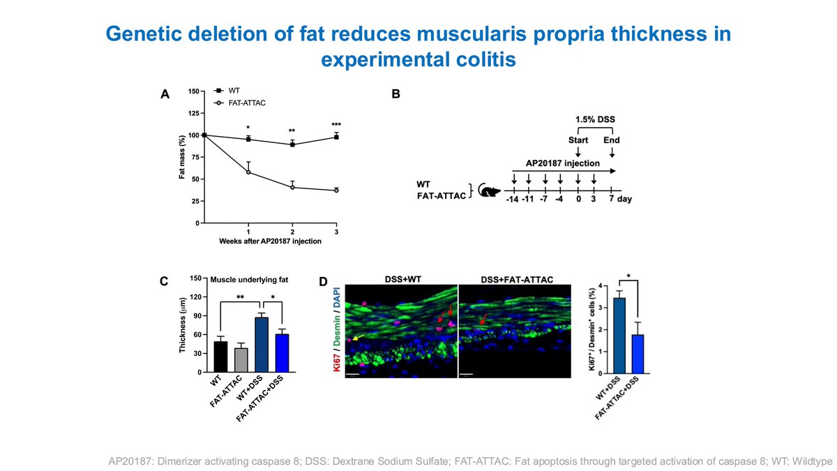 Florian Rieder (@ibd_flomd) on Twitter photo <a href="/DrSamirAShah1/">@Dr. Samir A Shah</a> <a href="/ownyourcrohns/">Tina Aswani-Omprakash, MPH</a> <a href="/ibdtweets/">Tauseef Ali MD, FACG AGAF FACP</a> <a href="/Alomari_MD/">Mohammad Alomari, MD</a> <a href="/DignassAxel/">Axel Dignass</a> <a href="/IBD_Afzali/">Anita Afzali MD, MPH, MHCM, FACG, AGAF</a> <a href="/RajaAtreya/">Raja Atreya</a> <a href="/IBDBen/">Benjamin Cohen MD MAS</a> <a href="/ManuelBragaMD/">Manuel Braga Neto</a> <a href="/BoutrosMarylise/">Marylise Boutros</a> <a href="/DrsMeena/">Meena Bewtra</a> <a href="/SophieBalzoraMD/">Sophie Balzora, MD, FACG</a> <a href="/CrohnsColitisFn/">Crohn's & Colitis Foundation</a> <a href="/HelmsleyTrust/">Helmsley Charitable Trust</a> <a href="/Mud_Fud/">Richard M. Wardrop III, MD, PhD, MACP, SFHM, FAAP</a> <a href="/DrYoonAn/">Dr Yoon-Kyo An</a> <a href="/KiraNewmanMDPhD/">Kira Newman, MD, PhD</a> <a href="/ExtracellMatrix/">Extracellular Matrix News</a> <a href="/SaraElOualiMD/">Sara El Ouali MD</a> <a href="/fgomollon/">Fernando Gomollón</a> Genetic deletion of fat reduces muscularis propria thickness in experimental colitis <a href="/NatRevGastroHep/">Nature Reviews Gastroenterology & Hepatology</a> <a href="/GianlucaPellino/">Gianluca Pellino</a> <a href="/guthealthmd/">Dr Mark Silverberg</a> <a href="/GI_PharmD/">Shubha Bhat, PharmD</a> <a href="/tinahamd/">Christina Ha MD</a> <a href="/HolubarStefan/">Stefan Holubar MD MS</a> <a href="/ruben_hernaez/">Ruben Hernaez</a> <a href="/ShomronH/">Shomron Ben-Horin</a> <a href="/JeremyAdlerMD/">Jeremy Adler, MD, MSc</a> <a href="/ibdseb/">Seb</a> <a href="/IBDProNews/">Crohn’s & Colitis Foundation IBD Pro</a> <a href="/Iris_Dotan/">iris dotan</a> <a href="/Y_ECCO_IBD/">Y-ECCO</a> <a href="/WashUMedIBD/">WashU Medicine Inflammatory Bowel Disease Center</a> 🧵 (3/7) <a href="/DrSamirAShah1/">@Dr. Samir A Shah</a> <a href="/ownyourcrohns/">Tina Aswani-Omprakash, MPH</a> <a href="/ibdtweets/">Tauseef Ali MD, FACG AGAF FACP</a> <a href="/Alomari_MD/">Mohammad Alomari, MD</a> <a href="/DignassAxel/">Axel Dignass</a> <a href="/IBD_Afzali/">Anita Afzali MD, MPH, MHCM, FACG, AGAF</a> <a href="/RajaAtreya/">Raja Atreya</a> <a href="/IBDBen/">Benjamin Cohen MD MAS</a> <a href="/ManuelBragaMD/">Manuel Braga Neto</a> <a href="/BoutrosMarylise/">Marylise Boutros</a> <a href="/DrsMeena/">Meena Bewtra</a> <a href="/SophieBalzoraMD/">Sophie Balzora, MD, FACG</a> <a href="/CrohnsColitisFn/">Crohn's & Colitis Foundation</a> <a href="/HelmsleyTrust/">Helmsley Charitable Trust</a> <a href="/Mud_Fud/">Richard M. Wardrop III, MD, PhD, MACP, SFHM, FAAP</a> <a href="/DrYoonAn/">Dr Yoon-Kyo An</a> <a href="/KiraNewmanMDPhD/">Kira Newman, MD, PhD</a> <a href="/ExtracellMatrix/">Extracellular Matrix News</a> <a href="/SaraElOualiMD/">Sara El Ouali MD</a> <a href="/fgomollon/">Fernando Gomollón</a> Genetic deletion of fat reduces muscularis propria thickness in experimental colitis <a href="/NatRevGastroHep/">Nature Reviews Gastroenterology & Hepatology</a> <a href="/GianlucaPellino/">Gianluca Pellino</a> <a href="/guthealthmd/">Dr Mark Silverberg</a> <a href="/GI_PharmD/">Shubha Bhat, PharmD</a> <a href="/tinahamd/">Christina Ha MD</a> <a href="/HolubarStefan/">Stefan Holubar MD MS</a> <a href="/ruben_hernaez/">Ruben Hernaez</a> <a href="/ShomronH/">Shomron Ben-Horin</a> <a href="/JeremyAdlerMD/">Jeremy Adler, MD, MSc</a> <a href="/ibdseb/">Seb</a> <a href="/IBDProNews/">Crohn’s & Colitis Foundation IBD Pro</a> <a href="/Iris_Dotan/">iris dotan</a> <a href="/Y_ECCO_IBD/">Y-ECCO</a> <a href="/WashUMedIBD/">WashU Medicine Inflammatory Bowel Disease Center</a> 🧵 (3/7)