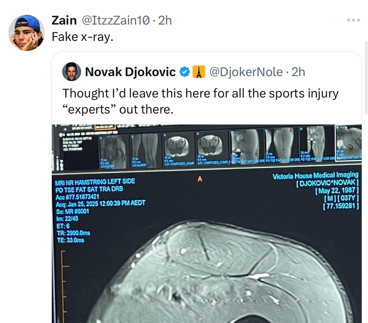A prime example of tennis “expert” <a href="/DjokerNole/">Novak Djokovic</a> was referring by to who doesn’t even understand the difference between an MRI and Xray
😂😂