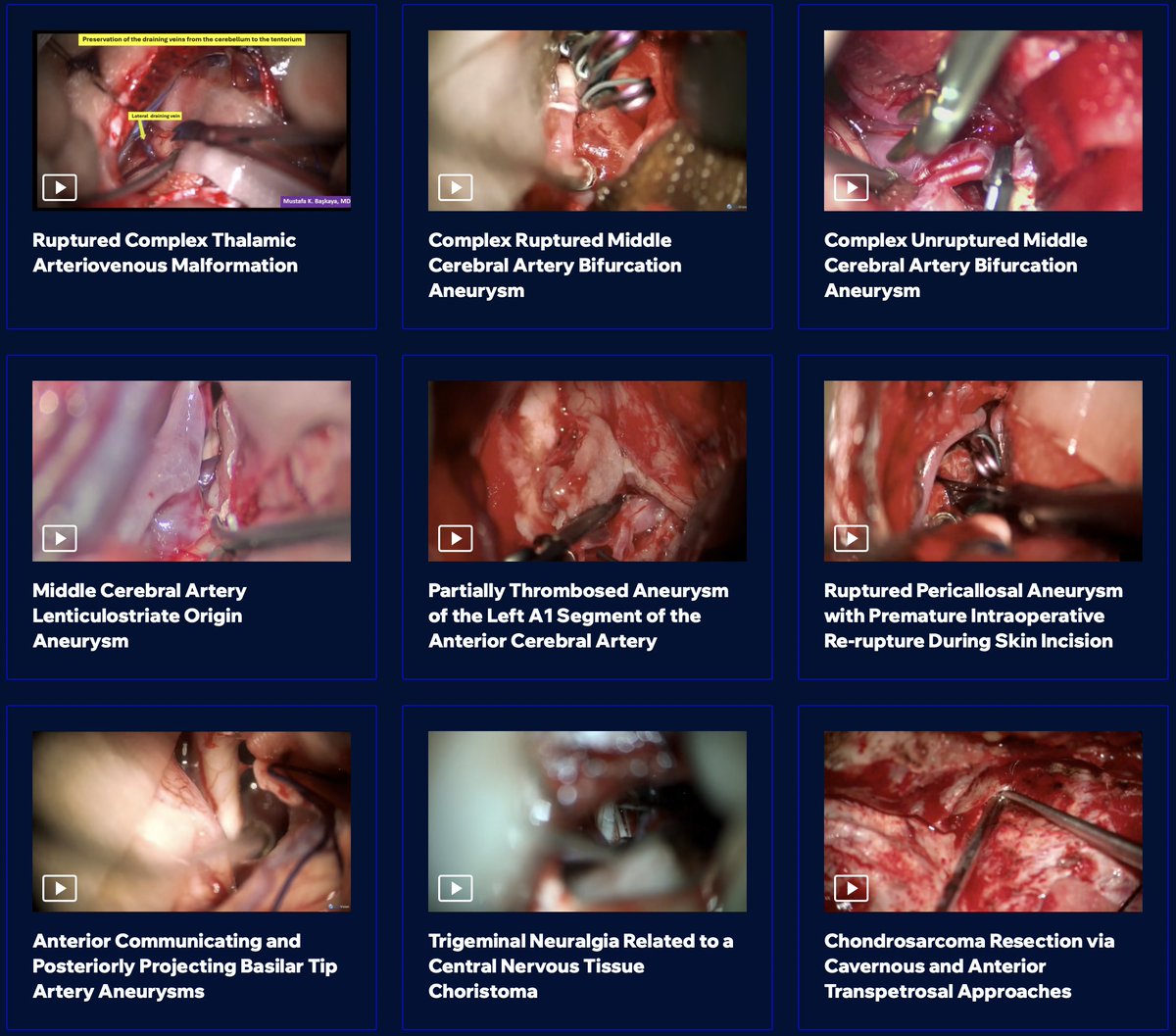 🚨 Exciting Update! 🚨
We now have 100+ surgical video cases in the Master Case Series on The Neurosurgical Atlas! 🧠✨

Explore now and elevate your practice:
🌐 The Neurosurgical Atlas

#Neurosurgery #Education #NeurosurgicalAtlas #SurgicalTechniques #uwhealth #uwmadison