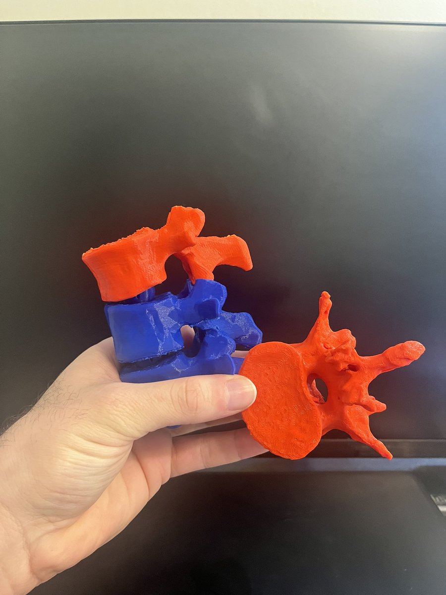 michaeljkamal's tweet image. Shoutout to the @McMasterU New Lyons Media centre for 3D printing these vertebrae for my anatomy lectures this week. They were a hit with the students!