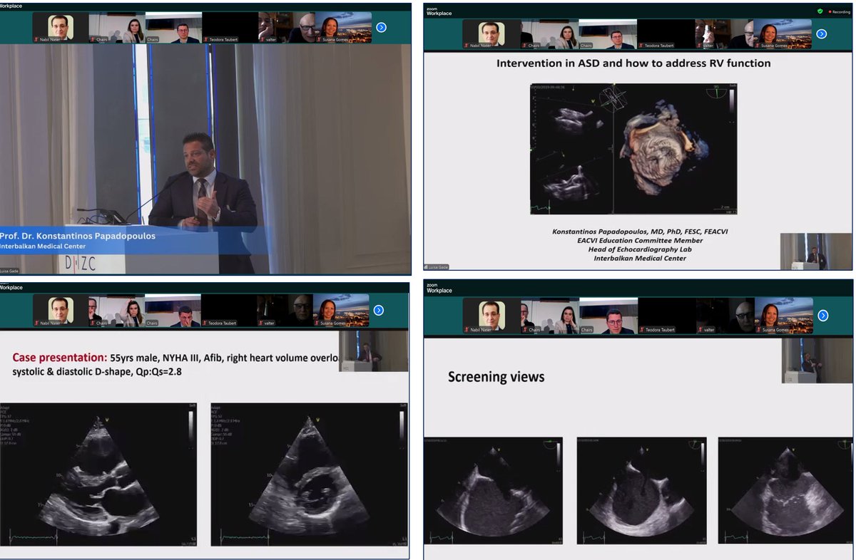 NabilNaser11's tweet image. It was a hot second day with great discussions. #3DEchoBerlin #echofirst Workshop by@DHZB_Akademie@dhzcharite. Congrats to @NM and other masters of 3D echocardiography. πβ₯οΈπ
