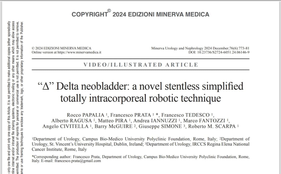 RoccoPapaliaUro's tweet photo. Robotic intracorporeal neobladder: make it easy! 
#HugoRAS #RoboticSurgery #Innovation #Urology #BladderCancer" https://t.co/vsk0EMiP2s