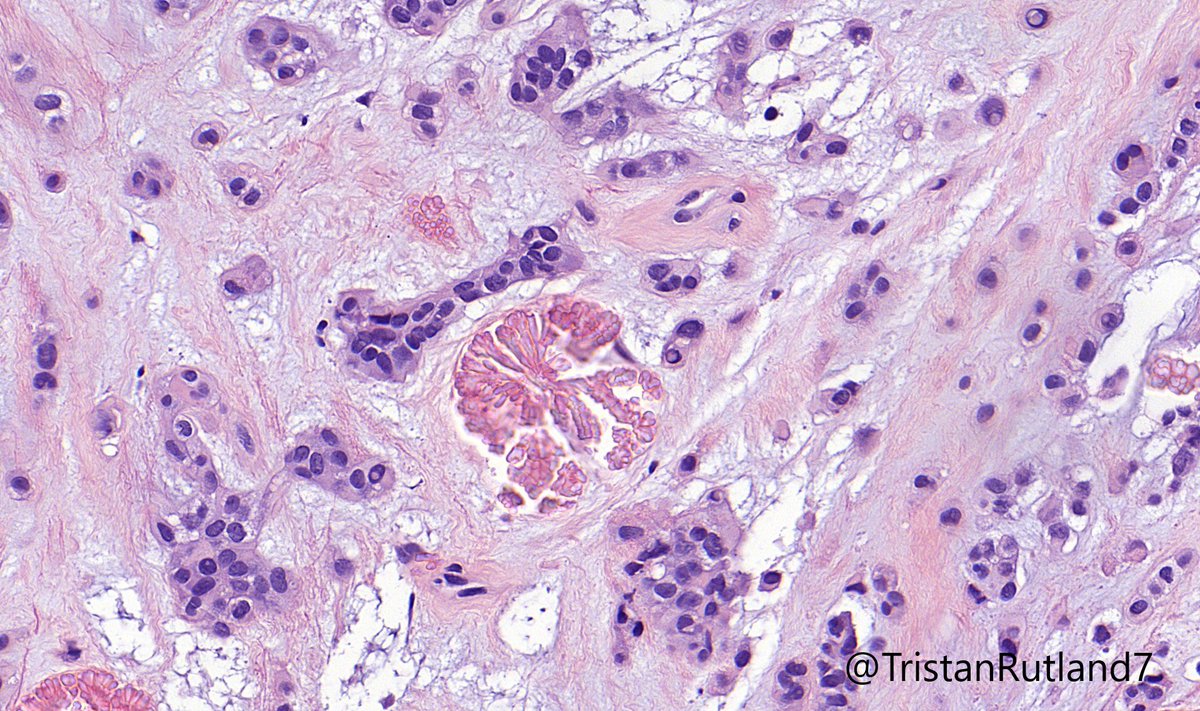 TristanRutland7's tweet photo. Here is the tumour.

Answers below. https://t.co/a9DRnLxl9Z