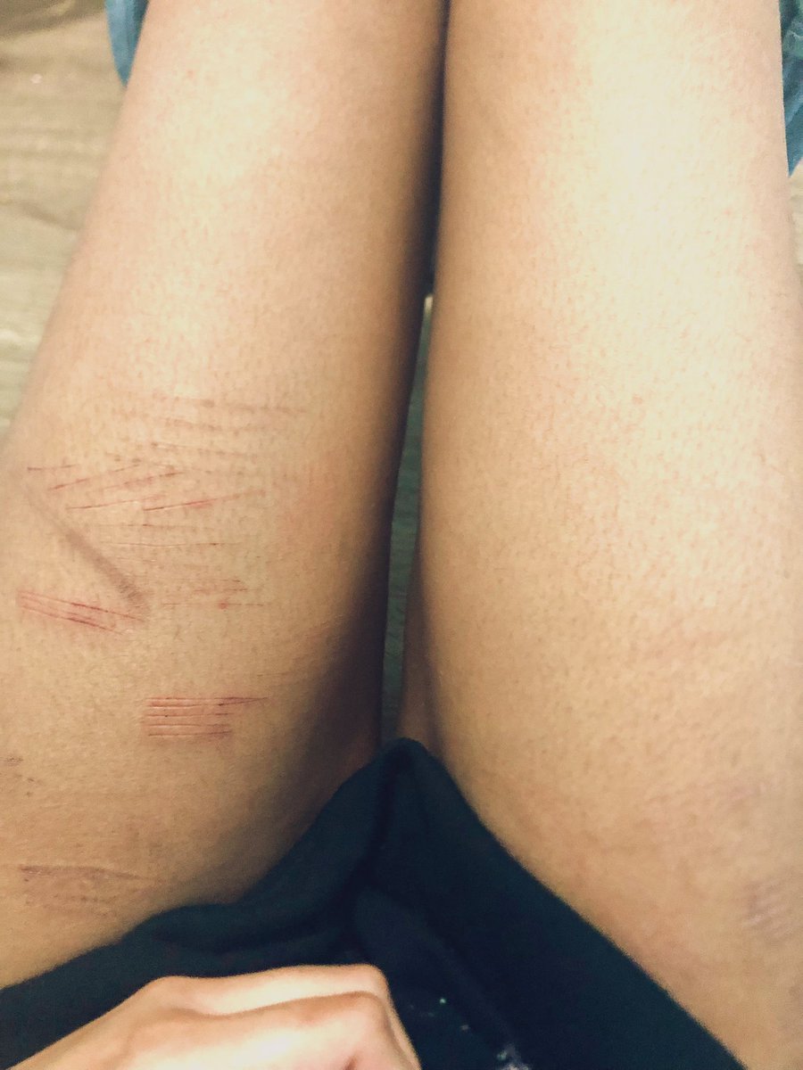 GetJinxed__Jinx's tweet photo. Thigh check #shtwt #shelfharm https://t.co/eDCaikIc0b