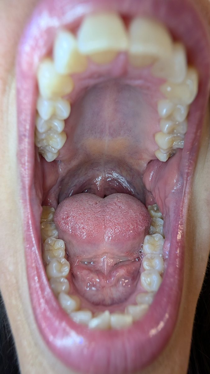 The Eatery (@mouth_goddess) on Twitter photo 