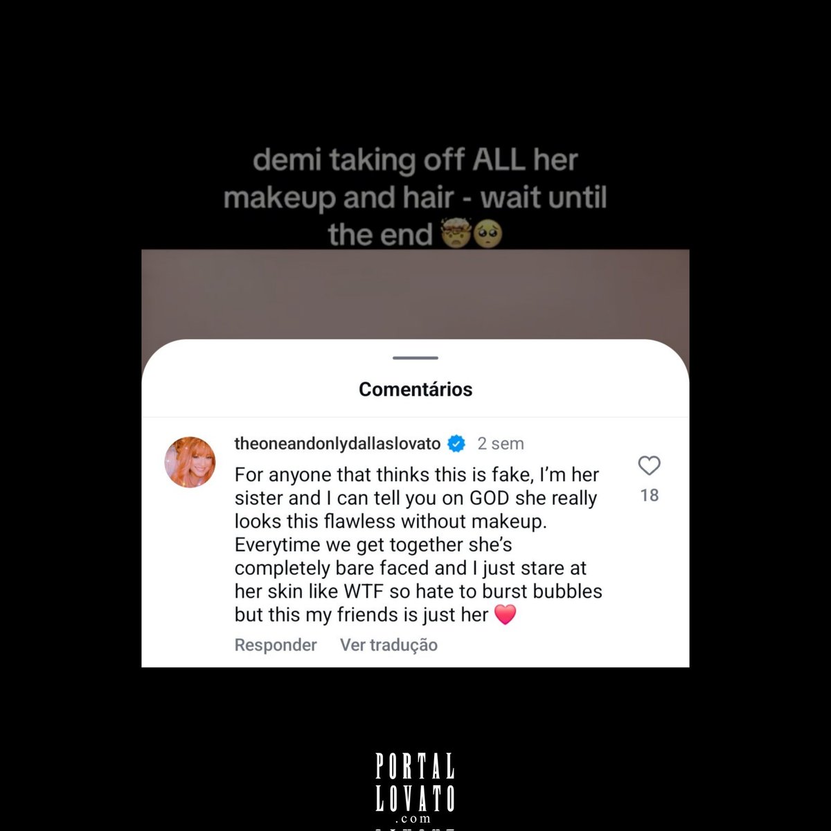 portallovato's tweet photo. Dallas, irmã de Demi Lovato, comentou em uma publicação de um fã-clube que compartilhava o vídeo "Demi Lovato Unfiltered: A Pop Star Removes Their Makeup", produzido para a Vogue em 2018. Nos comentários, algumas pessoas acusavam o vídeo de ser falso.

“Para quem acha que isso é falso, sou irmã dela e posso dizer, juro por DEUS, que ela realmente é impecável assim, sem maquiagem.

Toda vez que nos encontramos, ela está completamente de cara limpa, e eu só fico olhando para a pele dela tipo "que diabos". Então, odeio acabar com as ilusões, mas, meus amigos, isso é simplesmente ela.”