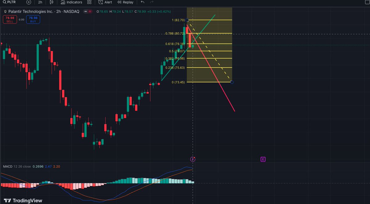 FixedGuru's tweet photo. my personal opinion of $PLTR in the next few days with a 2 hrs timeframe , never trust what you read &amp; do your own work @michaeljburry https://t.co/EaNnAtyyIx