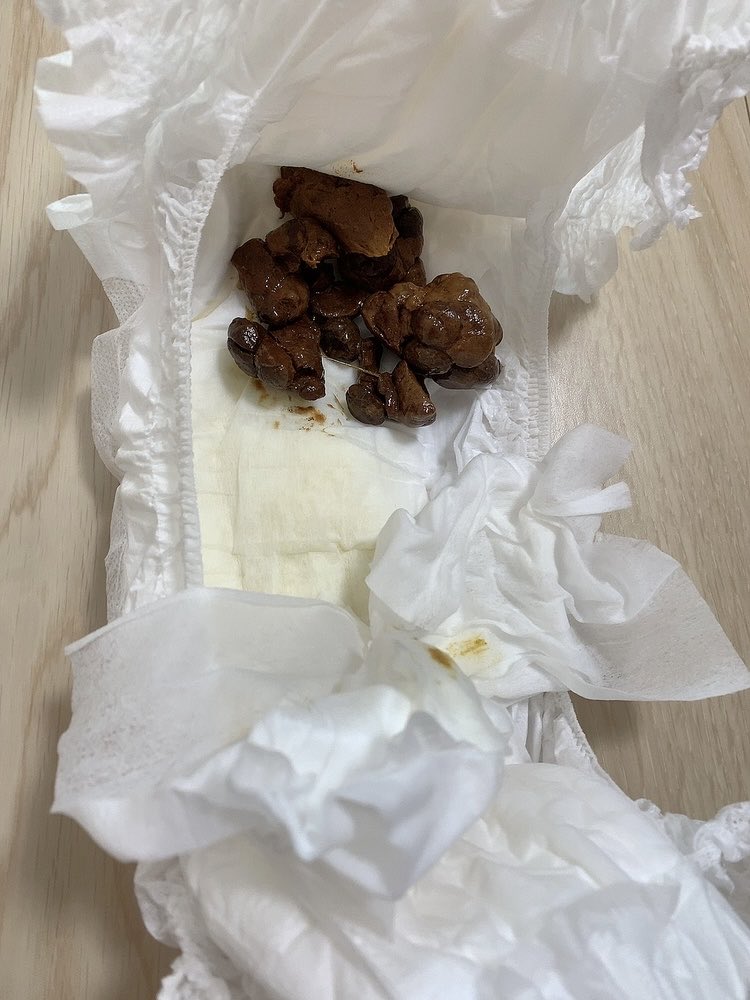 電車のってるときからしたくて降りてからおうちまで走ってるときにうんちでちゃった(っ ̫ ; ˘)