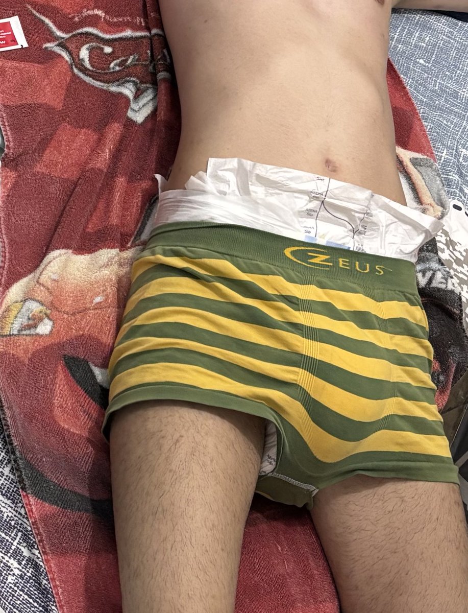 jonasabdl's tweet photo. Pov: sua fralda vazou à noite e tiveram que trocar vc e sua roupa de cama

Pov: your diaper leaks at night and they had to change you and your bedding

#diaperboy https://t.co/MJ9YIP5dBl