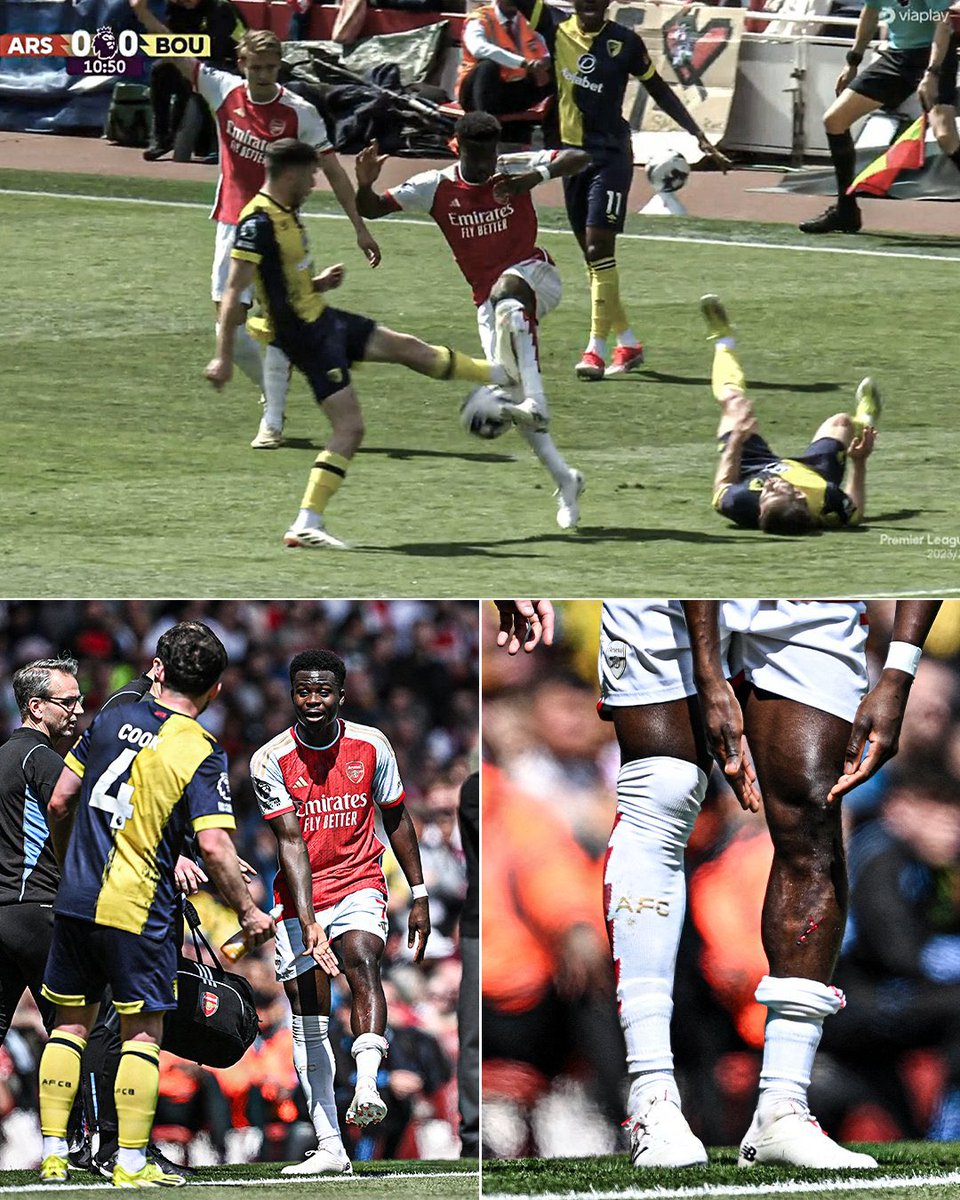 They’re tryna gaslight us about the Lewis Skelly tackle being “above the ankle” when they didn’t even give a yellow for this