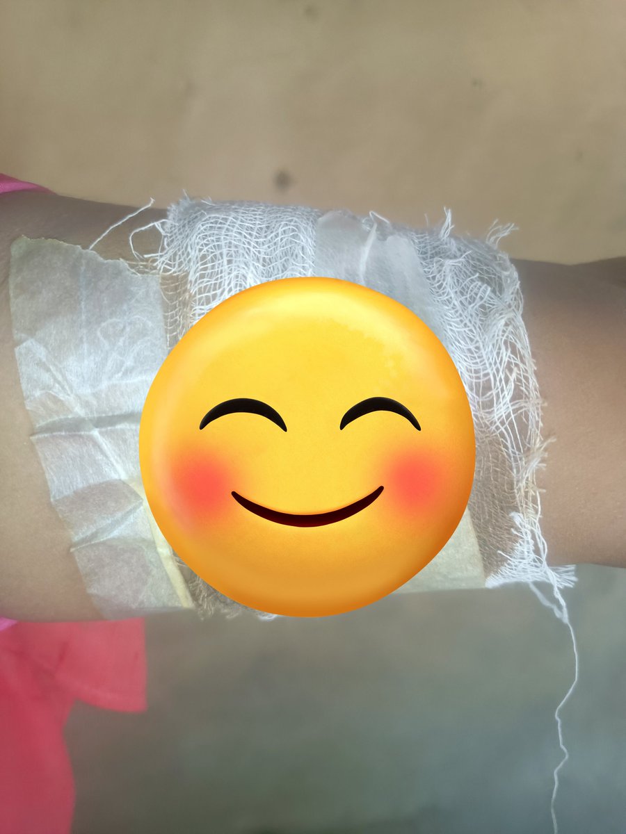 KoliFightsGBV's tweet image. Update:

Despite repeated visits &amp;amp; being told #RTMI no longer operates, the #Rohingya mother finally had her implant removed today by a kind senior lady doctor at #BRAC clinic. She’s grateful to the doctor who listened, but her struggle highlights systemic gaps. @AjitSinghCanada