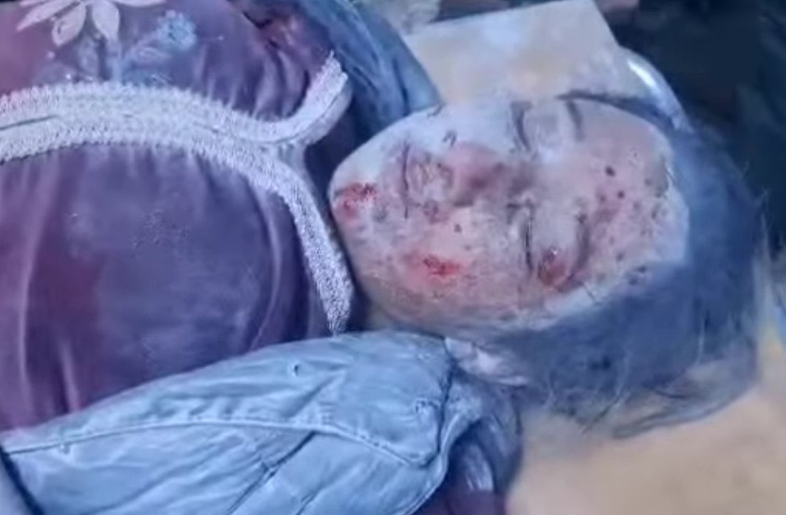farhad_shami's tweet photo. Update- The Turkish occupation commits another horrific massacre against innocent civilians NE Syria. This time in the village of al-Jamas in the eastern countryside of Ain Isa, where the Turkish occupation brutally shelled the populated village with heavy artillery, resulting in the martyrdom of one little girl, Asia Hamad al-Husein, and two other civilians were injured, the woman Areej Khaled al-Omar and the child Abdulrahman Ismael al-Husein.