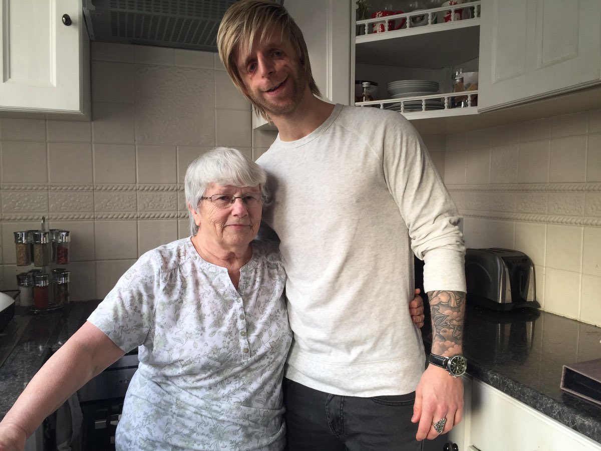 GossipRoomOff's tweet photo. 🚨 Abandonné à la naissance par ses parents biologiques en raison de son apparence causée par le syndrome de Treacher Collins, Jono Lancaster a connu un début de vie très difficile. Ce syndrome rare affecte le développement des os et des tissus faciaux, rendant son visage unique.

Heureusement, à l’âge de 5 ans, une femme au grand cœur l’a adopté, lui offrant une nouvelle chance dans la vie. Malgré les moqueries et le harcèlement qu’il a endurés en grandissant, Jono a décidé de transformer sa différence en force. Aujourd’hui, à 40 ans, il est devenu mannequin, un véritable symbole d’acceptation et de résilience. Mais son parcours ne s’arrête pas là : il consacre également sa vie à soutenir et inspirer les enfants atteints du même syndrome. Il visite des écoles, participe à des conférences, et sensibilise le public pour encourager l’inclusion et la diversité.

Jono est un exemple puissant de la manière dont on peut surmonter les épreuves pour devenir une source d’inspiration pour les autres. Un parcours extraordinaire qui prouve que l’amour et la persévérance peuvent tout changer ! 👏♥️ (via Daily Mail)