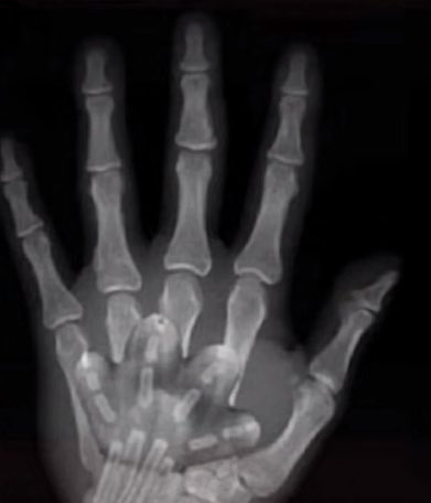 kusatta_wwwwwww's tweet image. じゃんけんで勝ったと思ったら写真判定であいこだったのほんま草