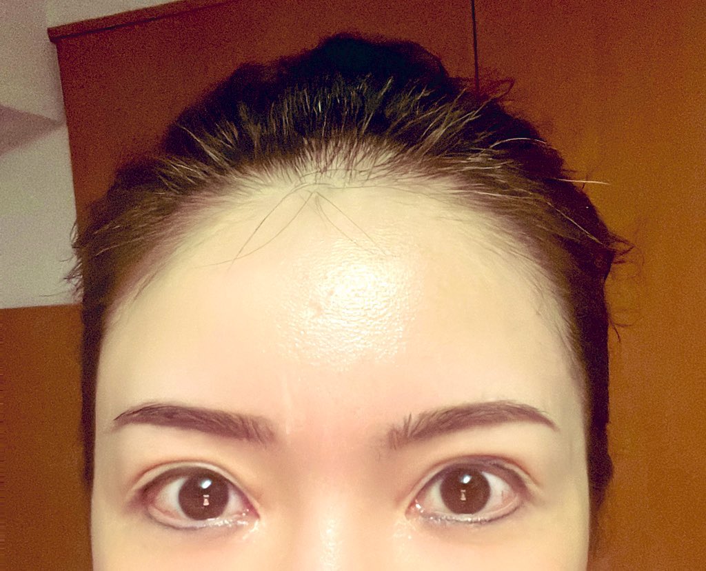 あちゃ(整形垢) (@MNcK4pjVAP7862) / Posts / X