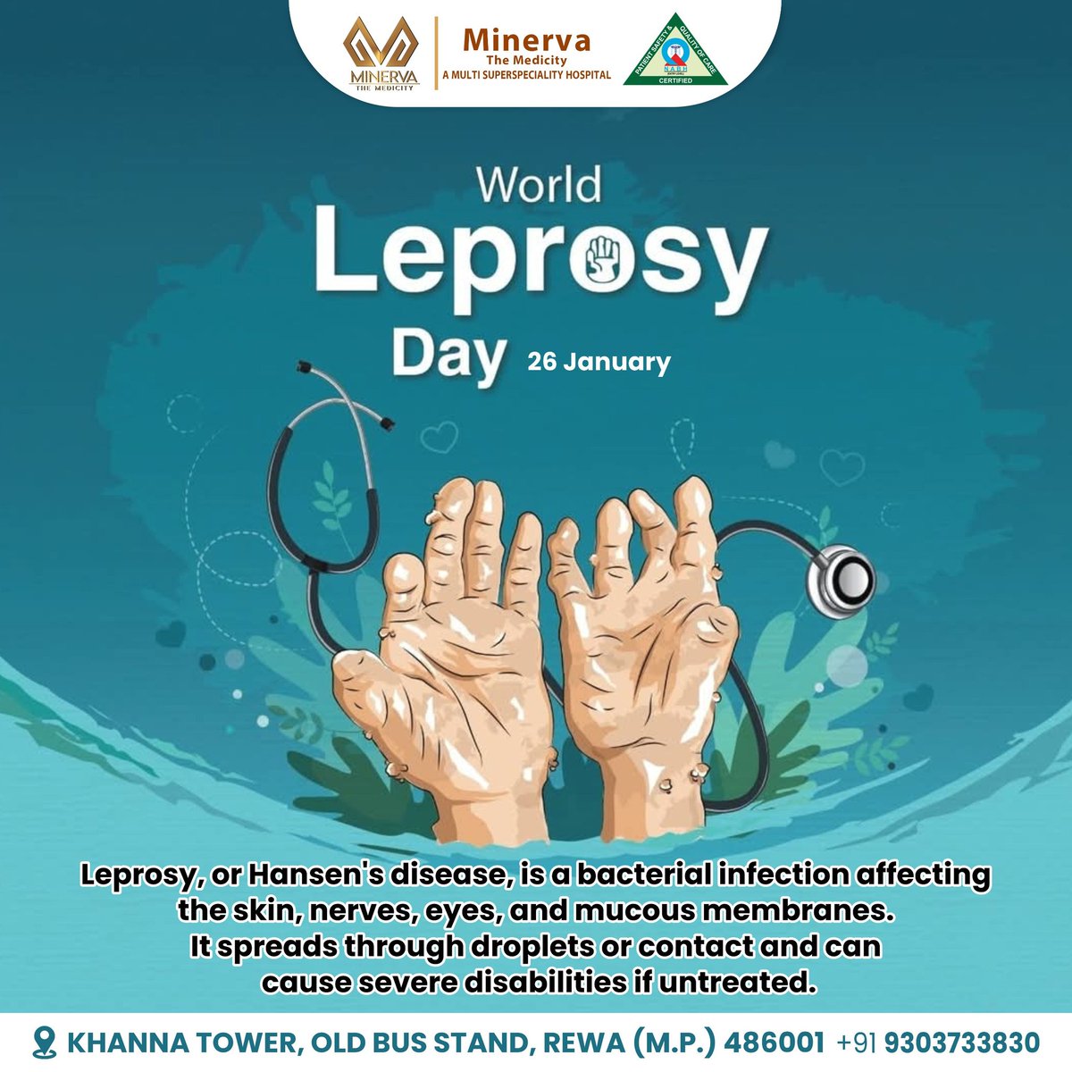 MedicityMinerva's tweet photo. World_Leprosy_Day

Leprosy, or Hansen's disease, is a bacterial infection affecting the skin, nerves, eyes, and mucous membranes.

It spreads through droplets or contact and can cause severe disabilities if untreated.

📍 Minerva The Medicity

#WorldLeprosyDay https://t.co/I6CQsGL8vW