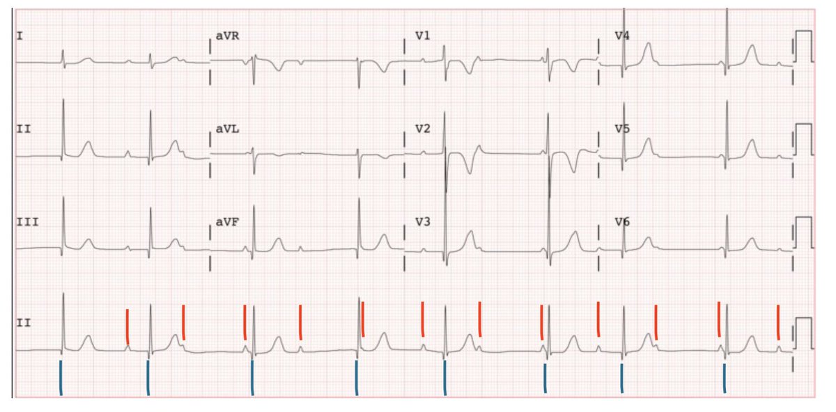 Tommy Chavero tweet media