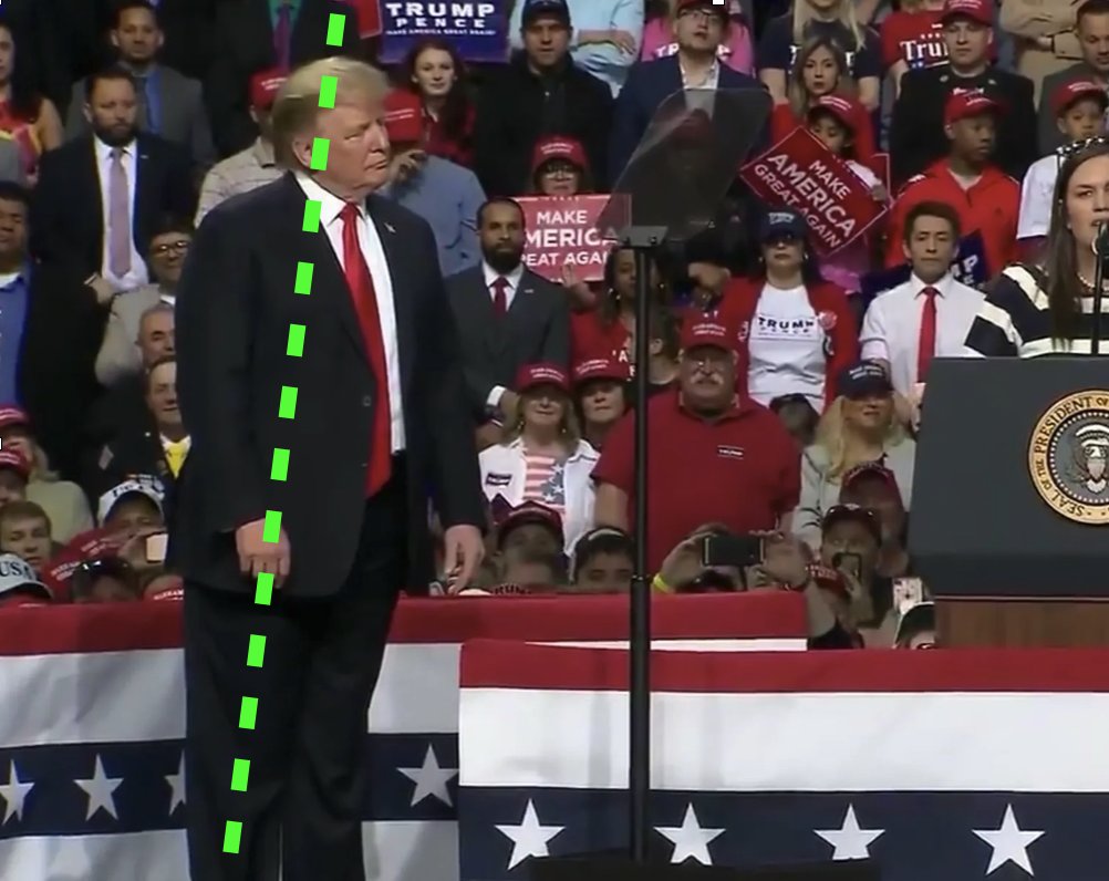 benschmidt1's tweet image. Habitually standing while leaning forward can be a symptom of several medical conditions. 
#PSA: If you or someone you know is experiencing this, it might be helpful to consult a healthcare professional for a thorough evaluation and appropriate management. #unfit