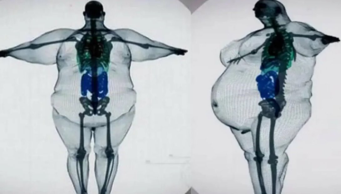 AB84's tweet image. Dave Blunts MRI…