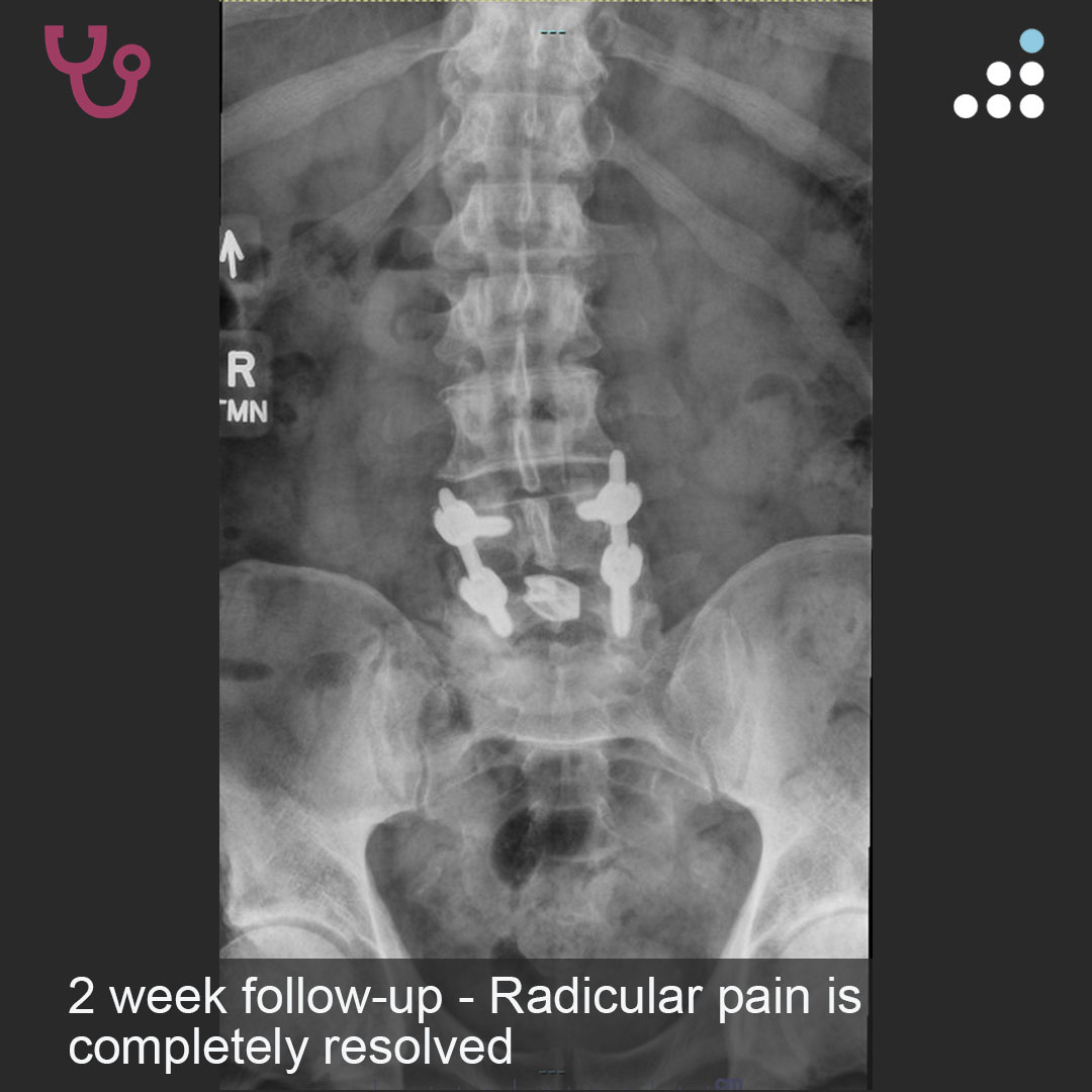 Orthobullets tweet media