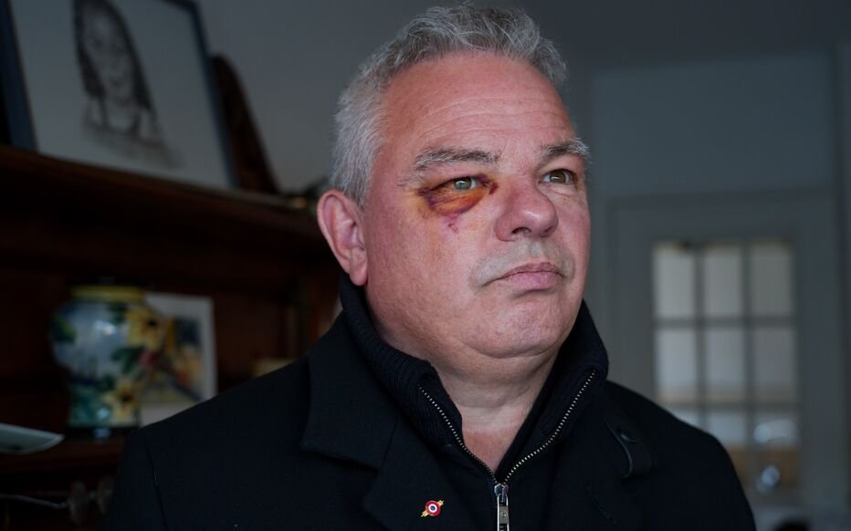 AnneTraviosa's tweet photo. Je le confirme ! Le maire d'une ville en Isère a été agressé parce qu'il avait une fille métisse. Il était également contre les discriminations, du coup des membres de l'ED ont tenté de le tuer... https://t.co/1SeSSlnNb3