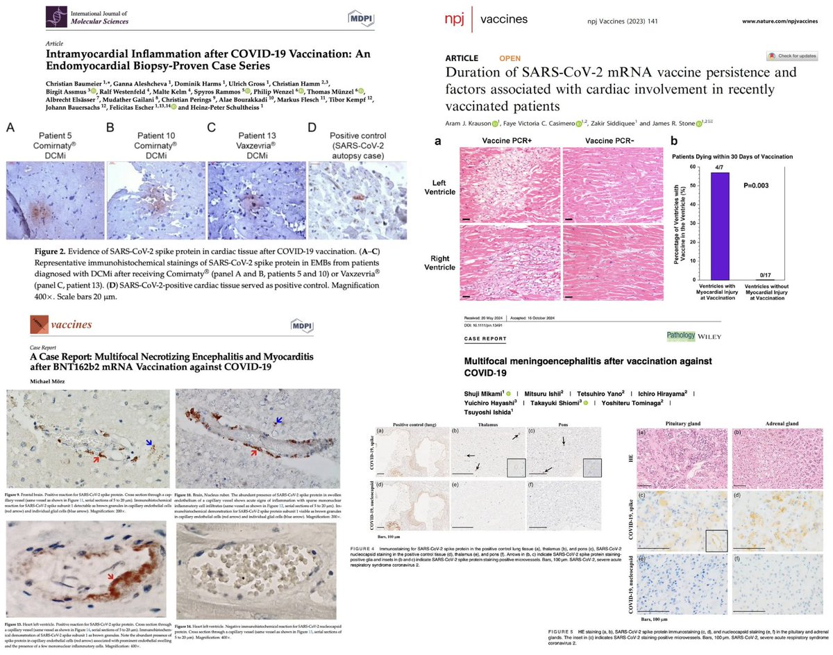 NicHulscher's tweet photo. COVID-19 mRNA injections distribute throughout the entire body and install Pfizer/Moderna modified genetic code in vital organs. The "vaccine" mRNA and/or resulting Spike protein has been found in the brain, adrenal glands, heart, and blood of injured and deceased individuals. https://t.co/QnTmMXEeAm