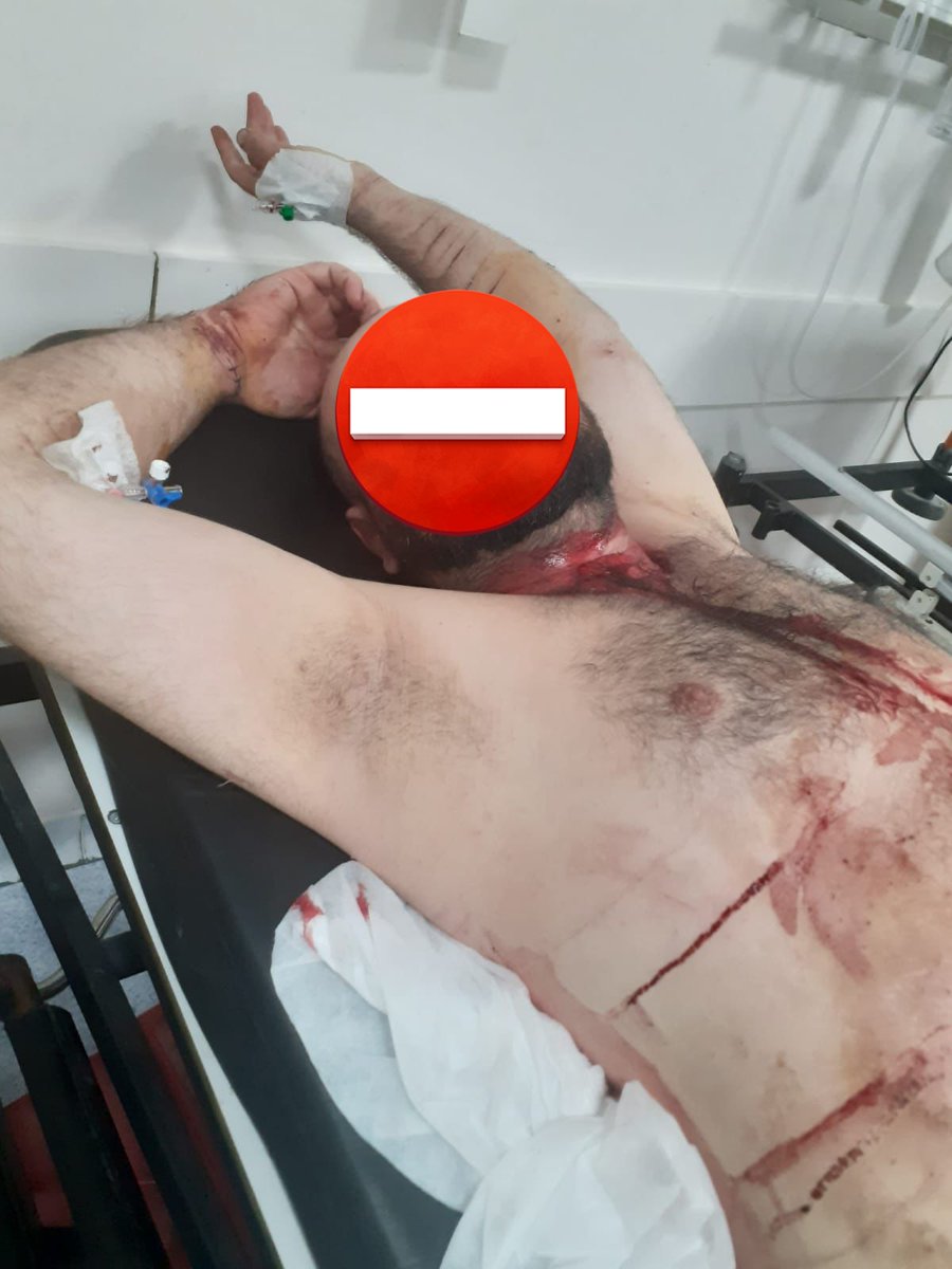 6 aydır bana ve yakınlarıma uzaklaştırması olan eski Kocam'a, Avukatımın yapmış olduğu Uzaklaştırma uzatma talebi reddedildi ! Gerekçe olarak, bu 6 ay içinde bana musallat olmaması gösterildi.
Evet, bana musallat olmadı, bu süre zarfında 2 suç işledi, kendini kesmediği yer