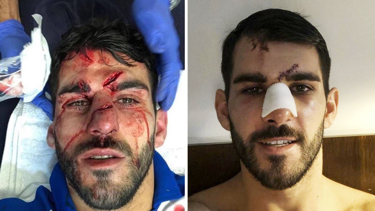 NikSmith89's tweet photo. “What has Mings done to deserve all these injuries?”

(Also, how’s he just catching the ball in open play and not receiving atleast a yellow?!) https://t.co/rrEXfygPGU