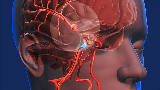 APRENDE LAS SEÑALES DE ADVERTENCIA DE UN ACCIDENTE CEREBROVASCULAR  

Un accidente cerebrovascular puede ocurrir en cualquier momento, a menudo sin previo aviso 🥲 

Conocer las señales puede salvar vidas y prevenir daños a largo plazo.  

Consulta el hilo 👇