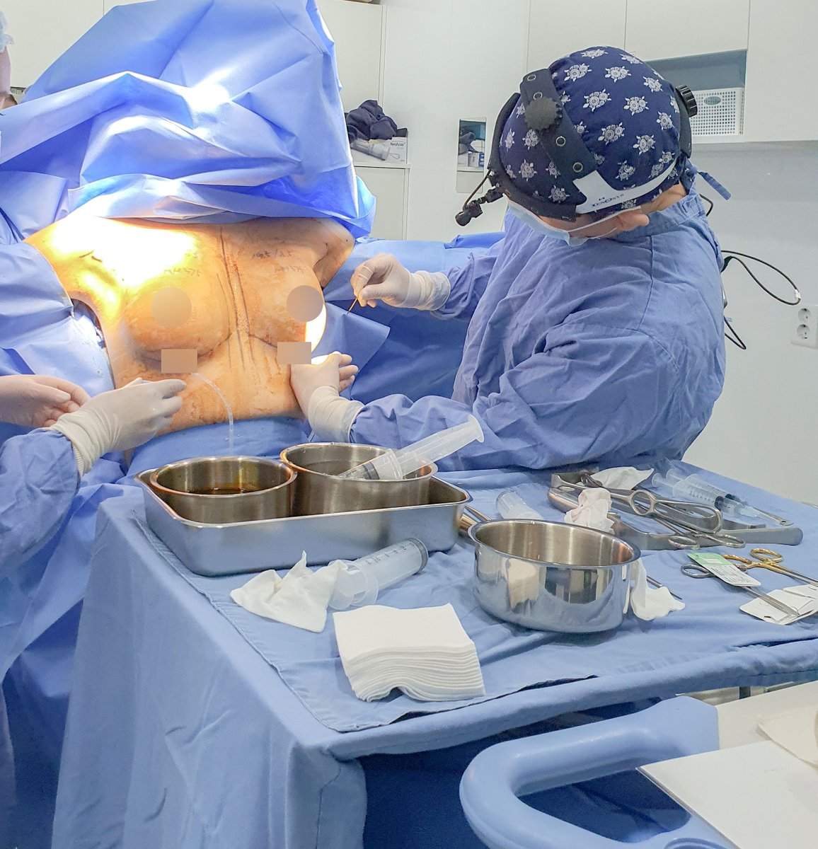 seojinps_eng's tweet photo. ✅ Verifying the implant size and position with a disposable Sizer! 🫧
Before inserting the actual #implant, a #Sizer is used to check for asymmetry, shape, and size in advance, ensuring the safe placement of the implant.
*Filmed under the patient's consent.
#BreastAugmentation https://t.co/K99NAW5LsU