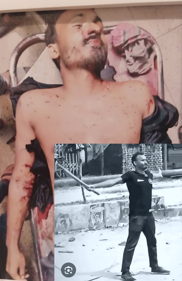 ttorongo's tweet image. Seems like a martyr from #Palestine? No. The smiling martyr is—Abu Sayed, who led the way to martyrdom in #Bangladesh’s July uprising. Such serenity, such glory! Direct sight of heavenly rewards could bring smile like that in face of death. Allahu Akbar! it was miracle!