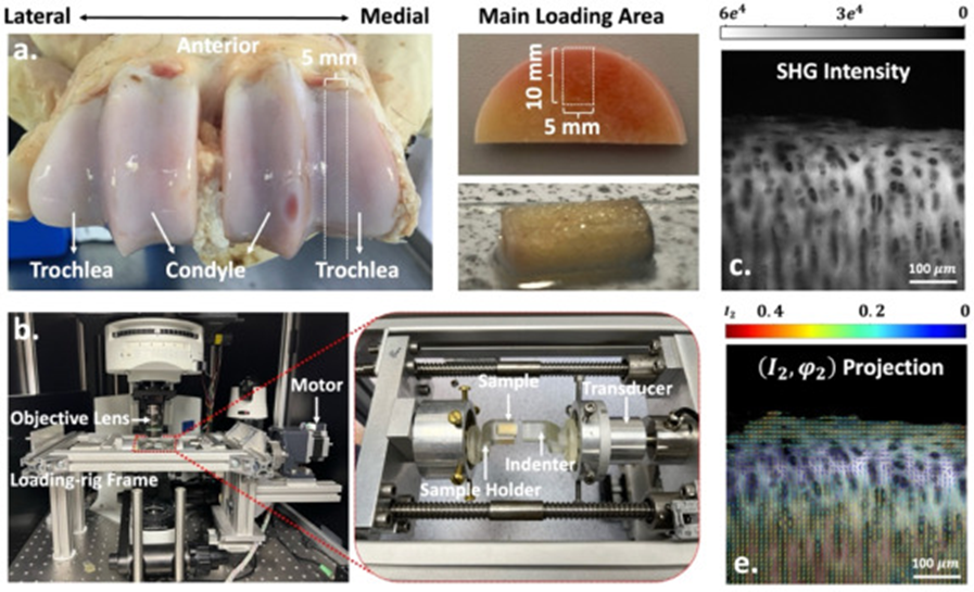 Junning Chen (@chen_junning) on Twitter photo Our latest work on #collagen ultrastructural responses to loading in #cartilage has been accepted by <a href="/ActaBio/">Acta Biomaterialia</a>! We will expand this framework to study the #injury and #degeneration of collagenous tissues and #biomechanics. Stay tuned! <a href="/EngExeter/">Exeter Engineering</a>
doi.org/10.1016/j.actb… Our latest work on #collagen ultrastructural responses to loading in #cartilage has been accepted by <a href="/ActaBio/">Acta Biomaterialia</a>! We will expand this framework to study the #injury and #degeneration of collagenous tissues and #biomechanics. Stay tuned! <a href="/EngExeter/">Exeter Engineering</a>
doi.org/10.1016/j.actb…