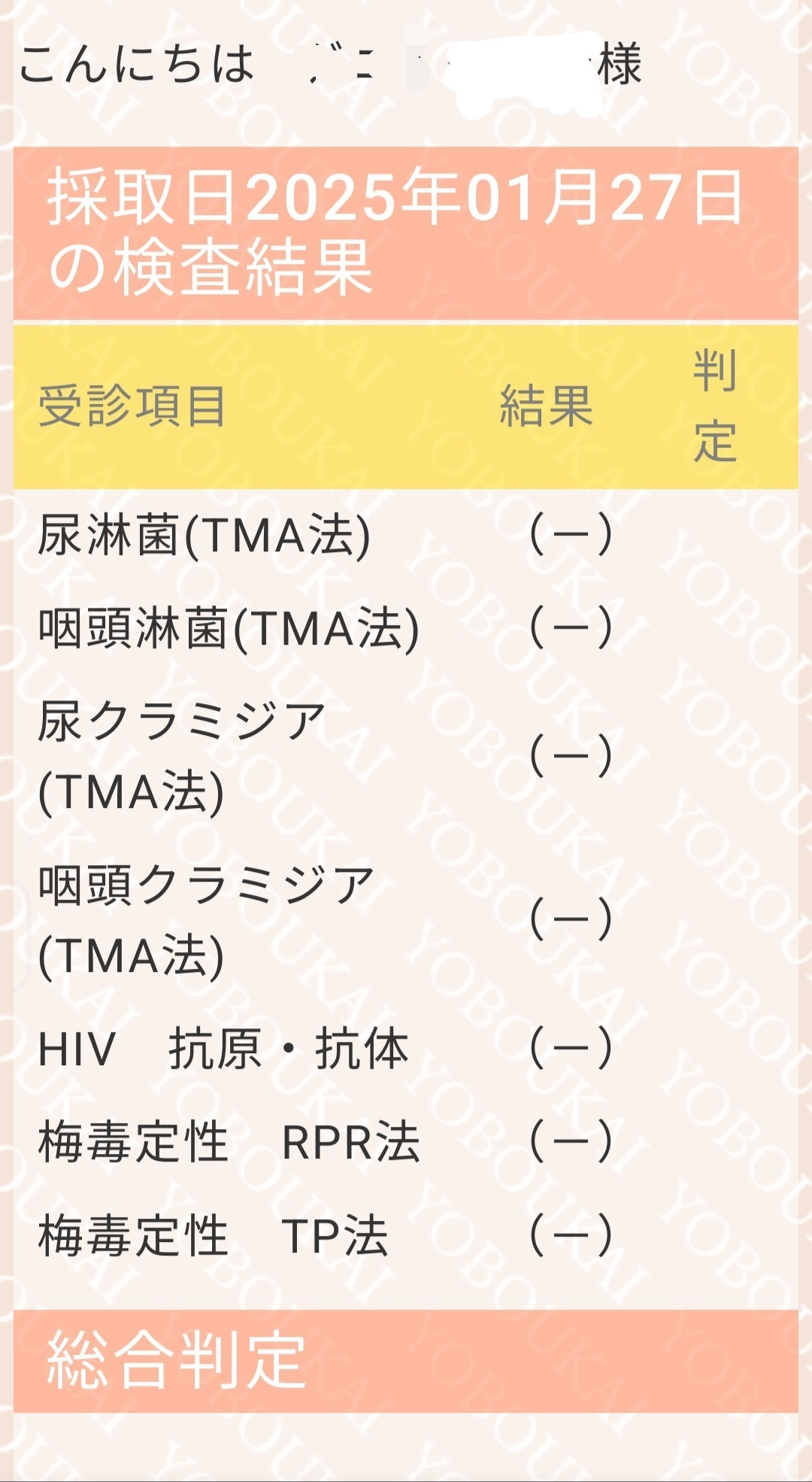 むんいさま確認ページ♡ BMW ミニ R56 SV16 ヨーレートセンサー 回転数センサー 未テスト