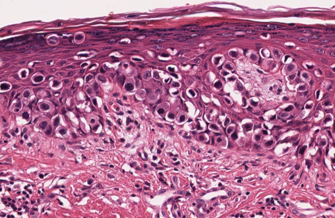 Virtual Pathology at The University of Leeds tweet media