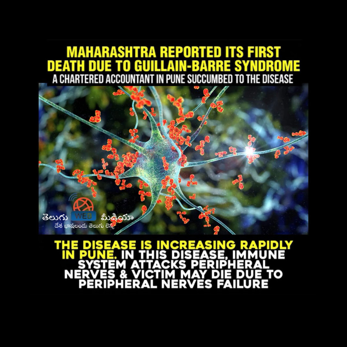 teluguwebmedia's tweet photo. In this disease, the immune system attacks peripheral nerves, and victims may die due to peripheral nerve failure."
#HealthAlert #GuillainBarreSyndrome
#GBSAwareness #PeripheralNerveDisorder
#autoimmunedisease #MaharashtraHealth #PuneHealthUpdate #HealthCrisis #GBSInIndia https://t.co/BY4dZ27fls
