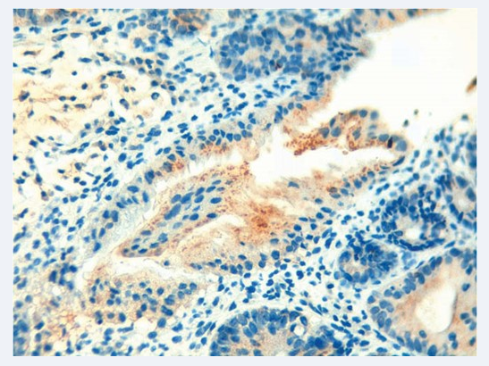 Harry Spoelstra tweet media