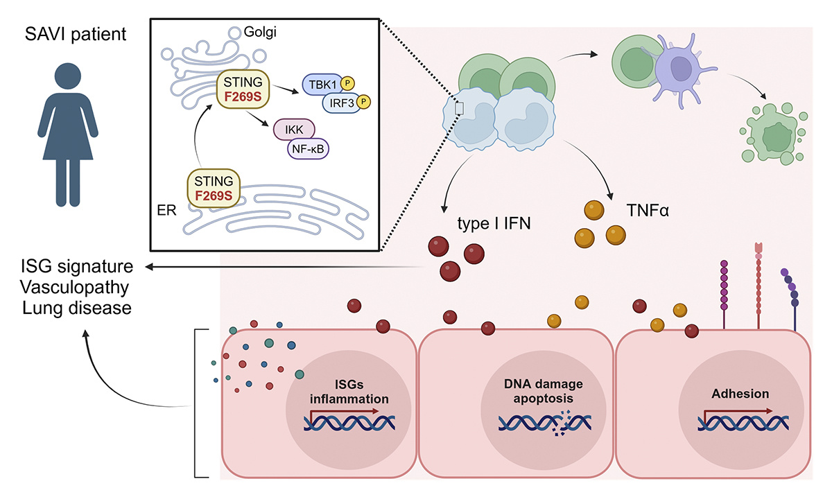 Journal of Experimental Medicine (@jexpmed) on Twitter photo .<a href="/EV_Erika_/">Erika Valeri</a> @KajasteLab et al characterize a novel STING variant that causes SAVI disease—a rare, genetic autoinflammatory disorder involving increased type I IFN and inflammatory signaling. hubs.la/Q033w6GM0
📘 In our #Immunology update collection: hubs.la/Q033wd590 .<a href="/EV_Erika_/">Erika Valeri</a> @KajasteLab et al characterize a novel STING variant that causes SAVI disease—a rare, genetic autoinflammatory disorder involving increased type I IFN and inflammatory signaling. hubs.la/Q033w6GM0
📘 In our #Immunology update collection: hubs.la/Q033wd590