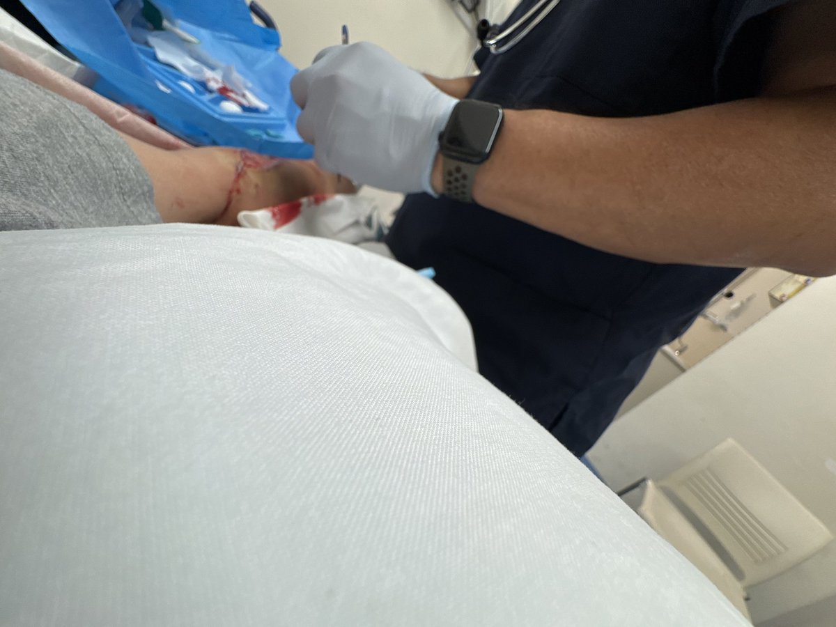 jj_blefgh's tweet photo. getting it stitched. total: 31 stitches https://t.co/Q18iXgtIAV