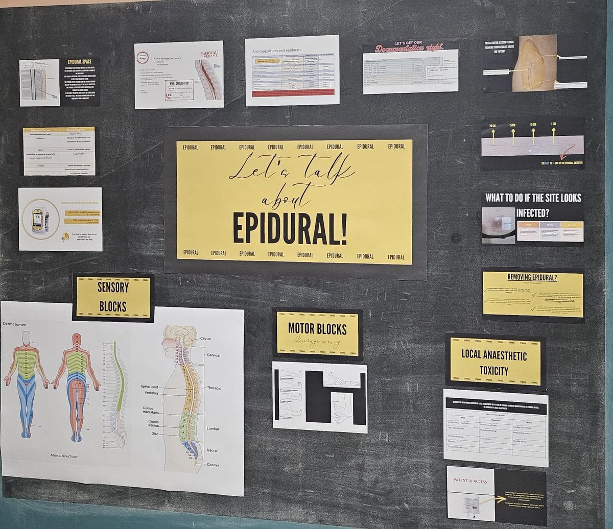 Charlotte Sear (@cesear90) on Twitter photo It’s epidural week <a href="/ITUHarefield/">ITU Harefield Hospital</a>. Well done to Jez for doing this fantastic visual board in the staff room.
Myself and Jez will be on the unit throughout the week educating staff on all things epidural <a href="/itunursecollins/">Ciara Collins 🇮🇪</a> <a href="/gerlaOne/">Emanuele Gerlando</a> <a href="/RBandH/">Royal Brompton and Harefield</a> It’s epidural week <a href="/ITUHarefield/">ITU Harefield Hospital</a>. Well done to Jez for doing this fantastic visual board in the staff room.
Myself and Jez will be on the unit throughout the week educating staff on all things epidural <a href="/itunursecollins/">Ciara Collins 🇮🇪</a> <a href="/gerlaOne/">Emanuele Gerlando</a> <a href="/RBandH/">Royal Brompton and Harefield</a>