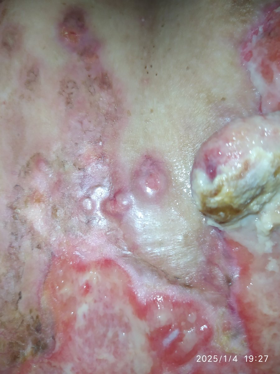 Yari - Lucho contra el Cáncer tweet media