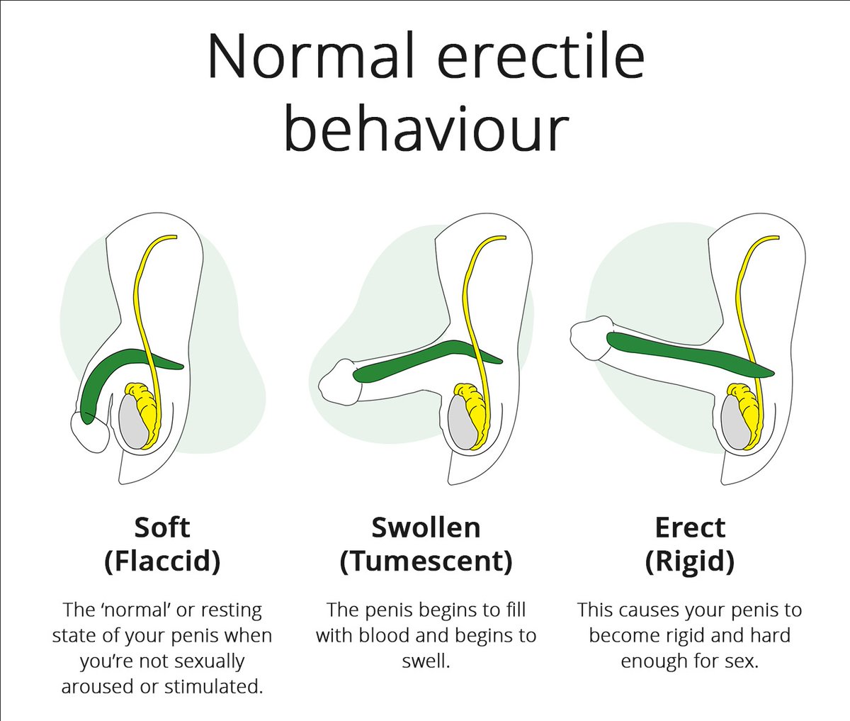 amerix's tweet image. A man&apos;s erection is a process that has 5 phases.

 • Latent:

The penis is at rest because there is no sexual arousal. 

• Tumescence:

Because of stimulation (thoughts or touch), the penis swells due to blood rushing into the blood vessels of the penis.

• Erection:

Blood…