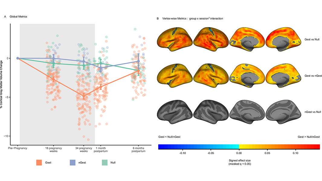 A study in <a href="/NatureComms/">Nature Communications</a> uncovers a U-shaped trajectory in gray matter volume during pregnancy and postpartum, linked to hormonal changes. Brain recovery postpartum correlates with maternal attachment. go.nature.com/4ho0Mm9