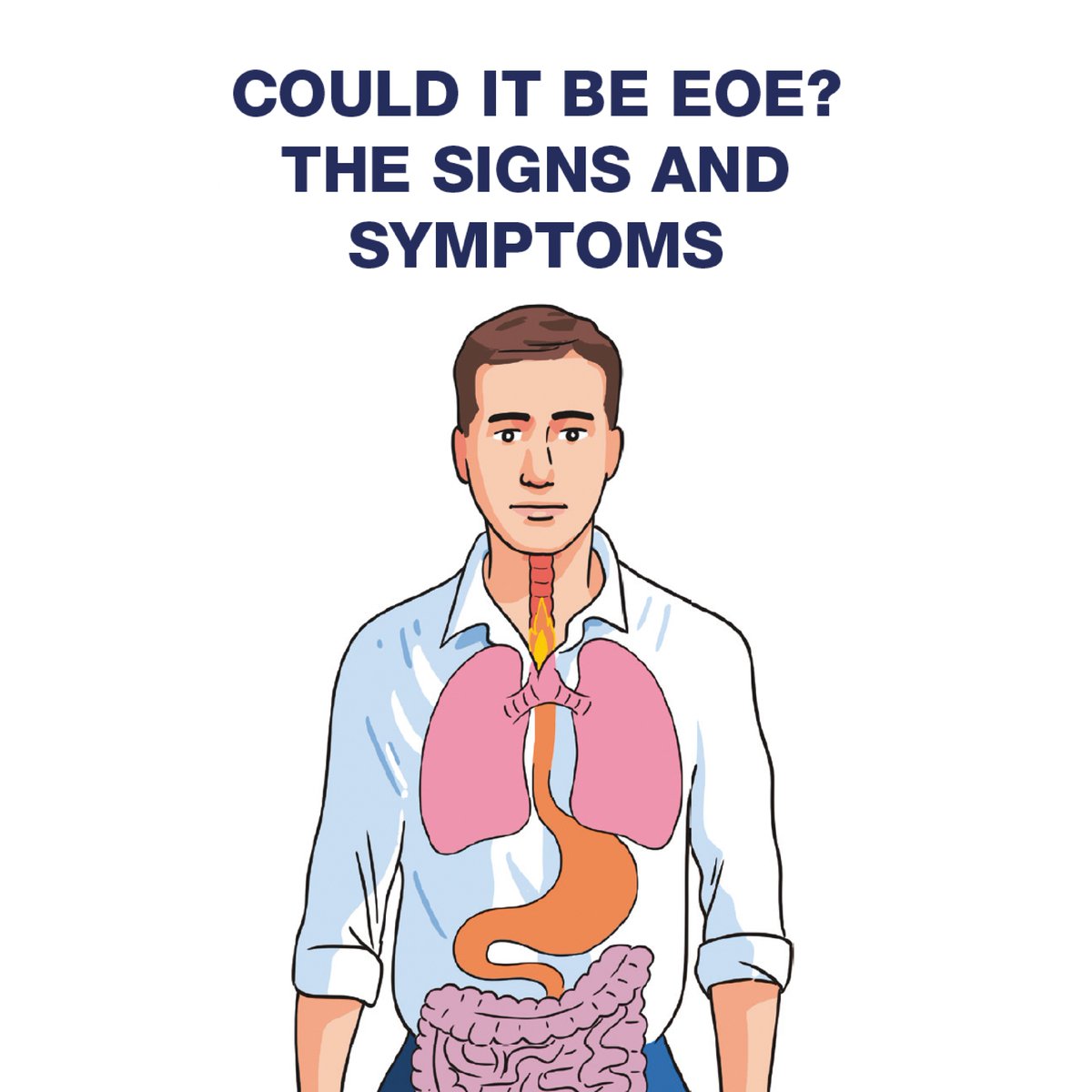 APFEDorg's tweet photo. 🚨New Resource Alert—Could It Be EoE? The Signs and Symptoms
Early awareness = better outcomes so download, share and spread the word today! 💙
https://t.co/aO7BsZcTJ5
#CouldItBeEoE #EoEAwareness https://t.co/lzZAIDGgu9